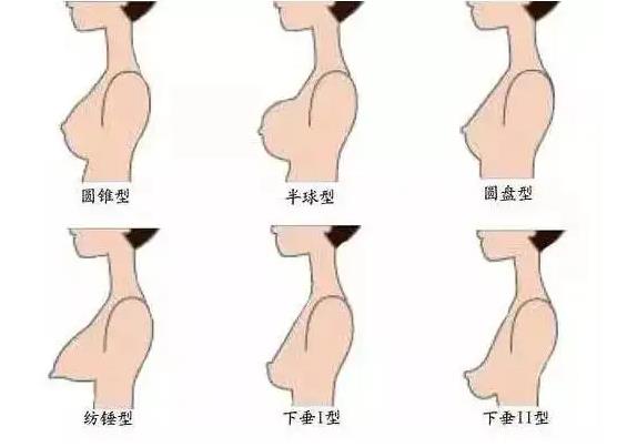常见的6种胸型都有什么特点？适合什么内衣